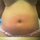 1yr ago B/F Lipo