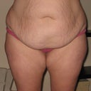 before pic