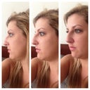 Befores