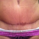 11 1/2 weeks