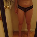 7 weeks post op... right before my menstrual cycle! A little bloated and still some swelling.