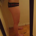 7 weeks post op.