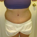 7 weeks po (front)