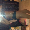 17 day post op. relaxed pose