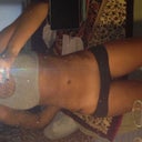 17 day post op. flexing a bit