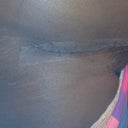 The side of incision post op 9 days ,still needs healing .