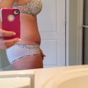 13 day side view. Still swollen down low but it's getting better!