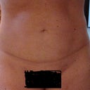Front view - four months