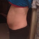 Taken day 5. Swollen, but has come down about 25% compared to what it has been the past few days.