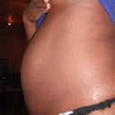 BEFORE SIDE VIEW