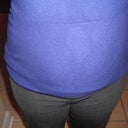 BEFORE FRONT VIEW W/ CLOTHES ON