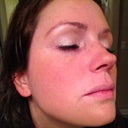 After the freckles have been sloughed off with my sugar shea face scrub.  This is the same side of the face as the close up with the dark freckles about to flake off. Taken Wed, Feb 22nd.