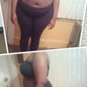 1 month pre-op