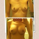 Before & After :)