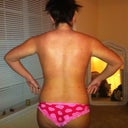back view 4 days post-op