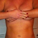 front view- waist and abdomen view