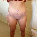 3 days post op