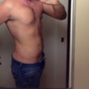 3 months (flank is still numb and swollen)