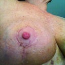 Don't know why this nip looks so red and angry.  It's not.  It's very happy :)  Even the incision looks angry and yet, it's equally happy.  Bust be the flattering bathroom lighting.