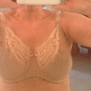 Prima Donna 36G at 2 weeks post-op with a lot of swelling still to go.  (What cleavage?!? Crap, I'll have to start setting my underarm hair on fire like the guy at my 18 year-old's birthday party....)