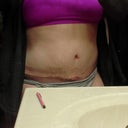 5 Weeks. Swollen?