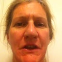 day after treatment