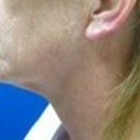 Before (side view)