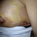 Right breast very sore:(