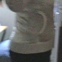 Before surgery. Sorry so blurry. It shows how deflated I was on the top.