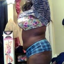 I had to do the other side so u could c my hip is swollen to Post op day 5