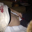 Post op day 1, I can't stand up and take a picture at the same time yet.