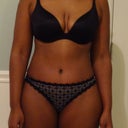 3.5 weeks po....end of the day swelling