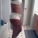 5 1/2 weeks swell hell side swollen more near incision looks 3 months preggo
