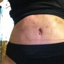 Going in???? Hopefully.  Today is 01/01/2013. Will post pics in a couple of weeks to see if it stays in.  Wish me luck!