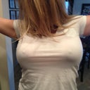 3 weeks post op!