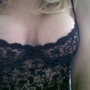 10 days post op. Left breast is still swollen and tight so they aren't even yet but I love them :) One thing I love about the size and shape of my implants is that I can wear them conservative or push them up nice and round. For my hubby only ;)