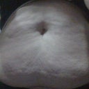 10/30/11 Day before 2nd consult  Down from 210 pounds to 160.