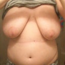 this is the before. do you think its worth surgery?