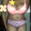 Swollen but coming along mighty fine