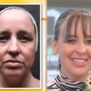 Me before and 6 weeks post on Good Morning Texas