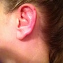 left ear photo 2