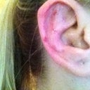 Right ear