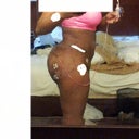 Post op day 4. Shawty got a ass on her! Can you say projection projection projection? Yes!