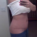 side view almost 4 wks post op