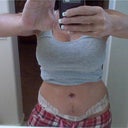 About one week after surgery.