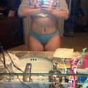 Post op day 11, day i got my drains out.