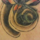 6 weeks after 2nd session - close up, i see lot's of breakup here