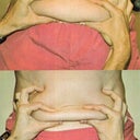 Front view.  Top photo is on September 28th, 2012.  Bottom photo is on February 1, 2013.