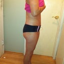 11 days PO.. standing much straighter!
