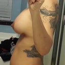 1 Week Post Op - side